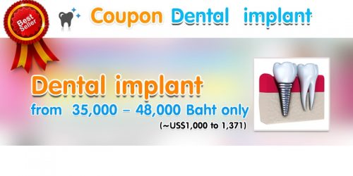 Dental implant2