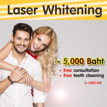 Laser Whitening - 5,000 Baht (~US$142)