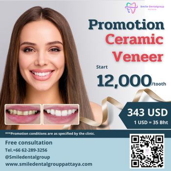 pro_veneer_en2