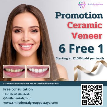 pro_veneer_en3