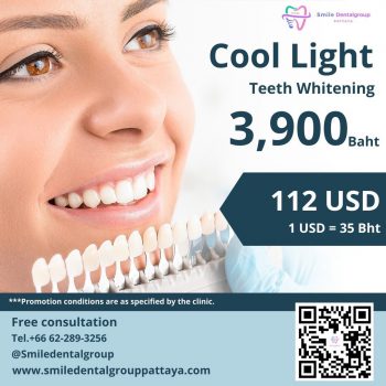 Promotion-Cool-Light-Teeth-Whitening