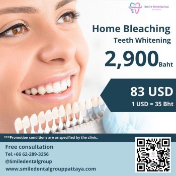 Promotion-Home-Bleaching-Teeth-Whitening