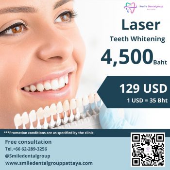 Promotion-Laser-Teeth-Whitening