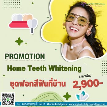 pro_teeth_whitening1