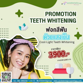 pro_teeth_whitening2