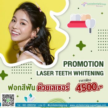 pro_teeth_whitening3